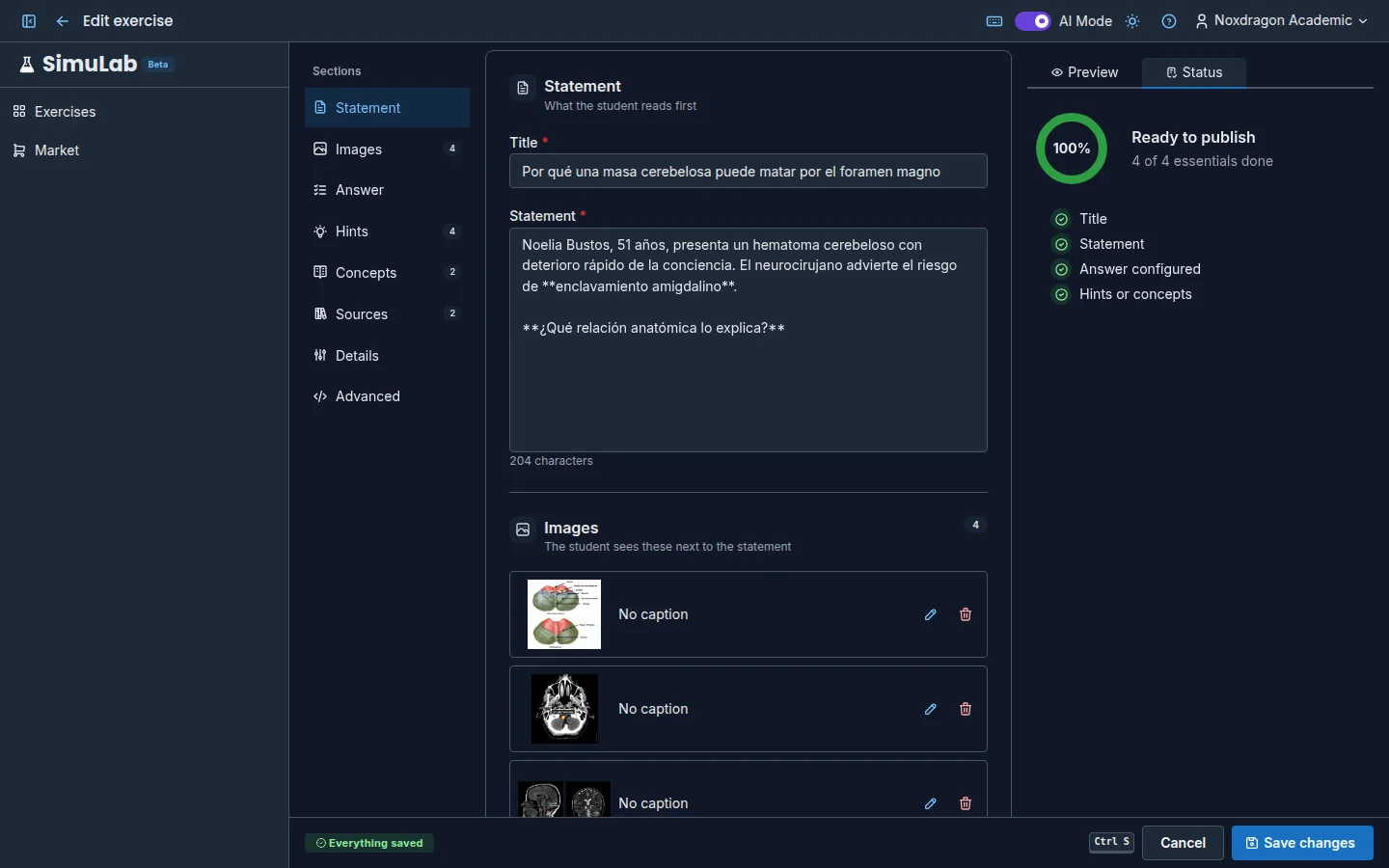 Editor completeness checklist with the answer section (sample content in Spanish)