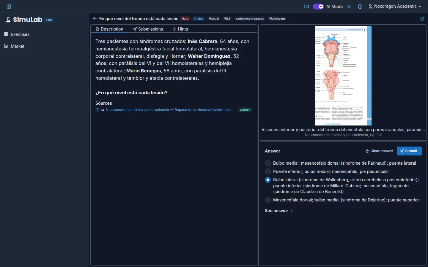Multiple-choice answer panel (sample content in Spanish)