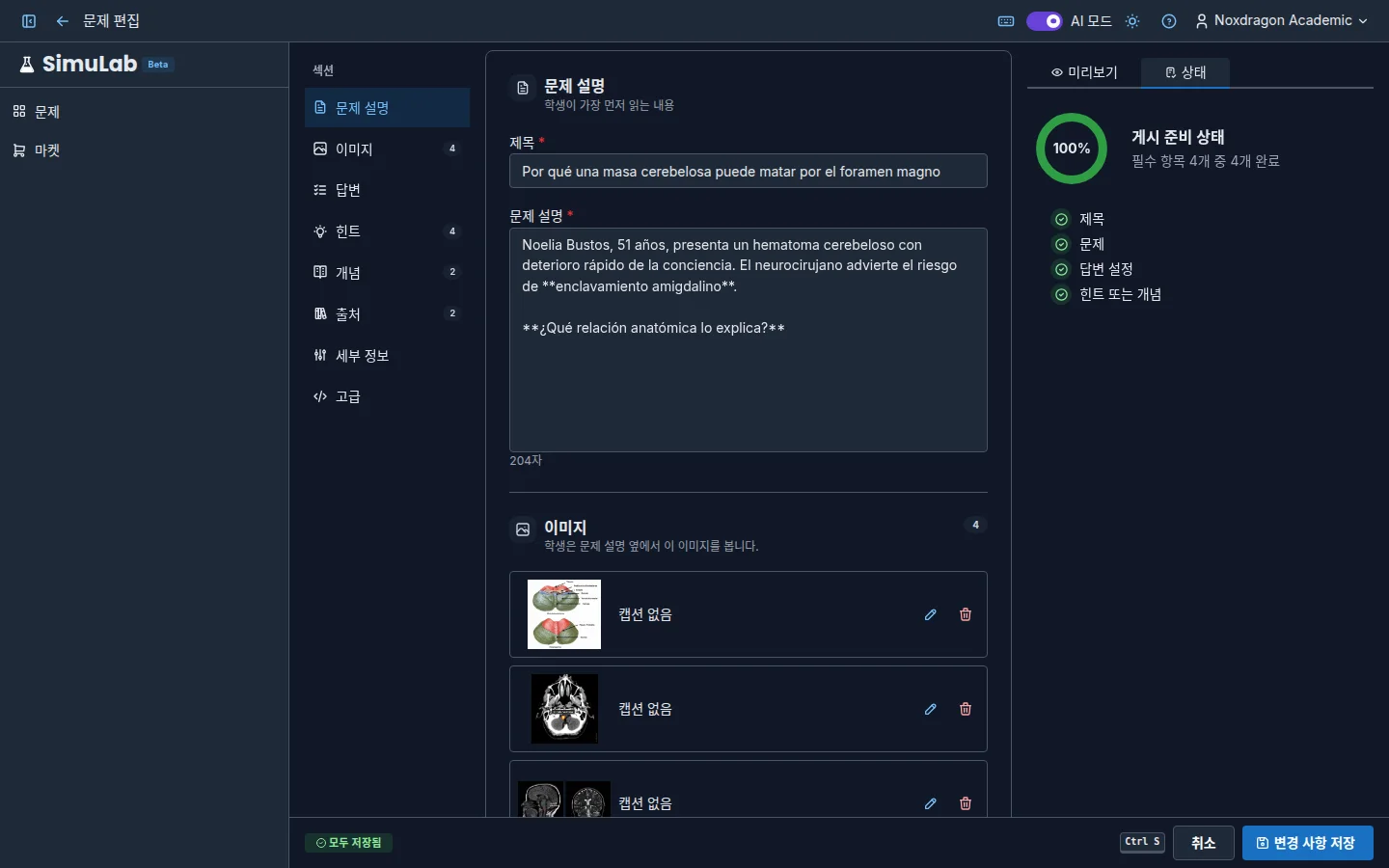 답변 섹션과 편집기 완성도 체크리스트(예시 콘텐츠는 스페인어)