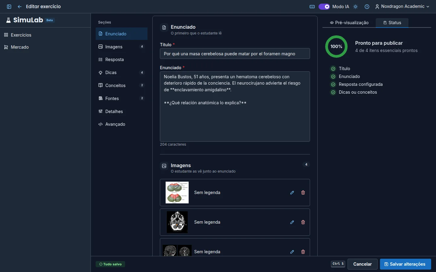Lista de completude do editor com a seção de resposta (conteúdo de exemplo em espanhol)